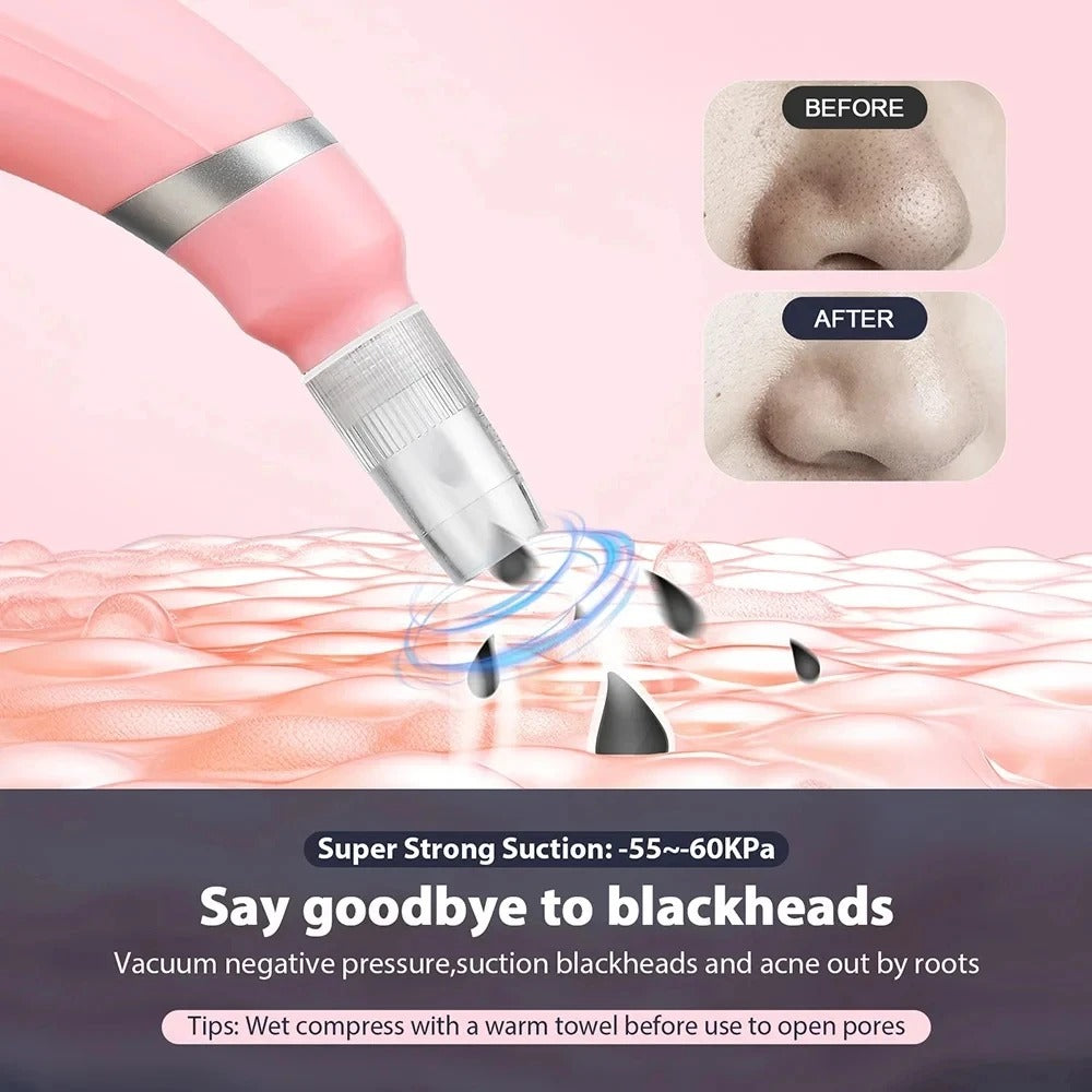 Blackhead Remover Vacuum Tools