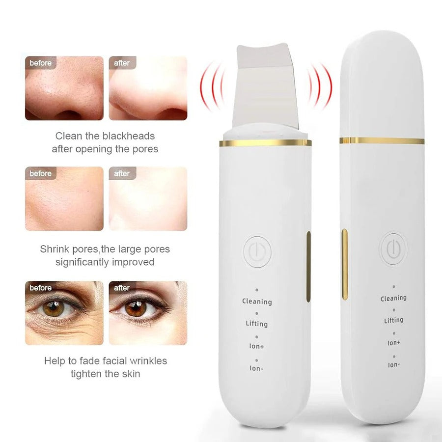 Ultrasonic Skin Scrubber